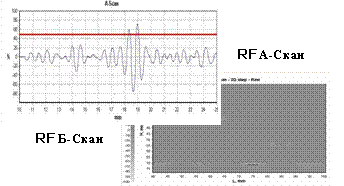 RF signal display
